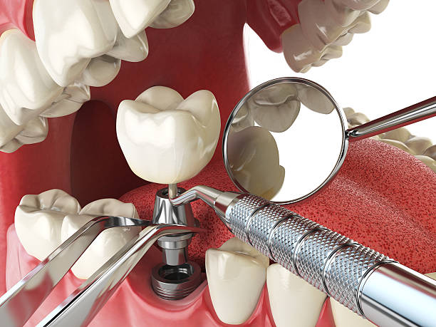 Best Emergency Dental Surgery in South Creek, WA